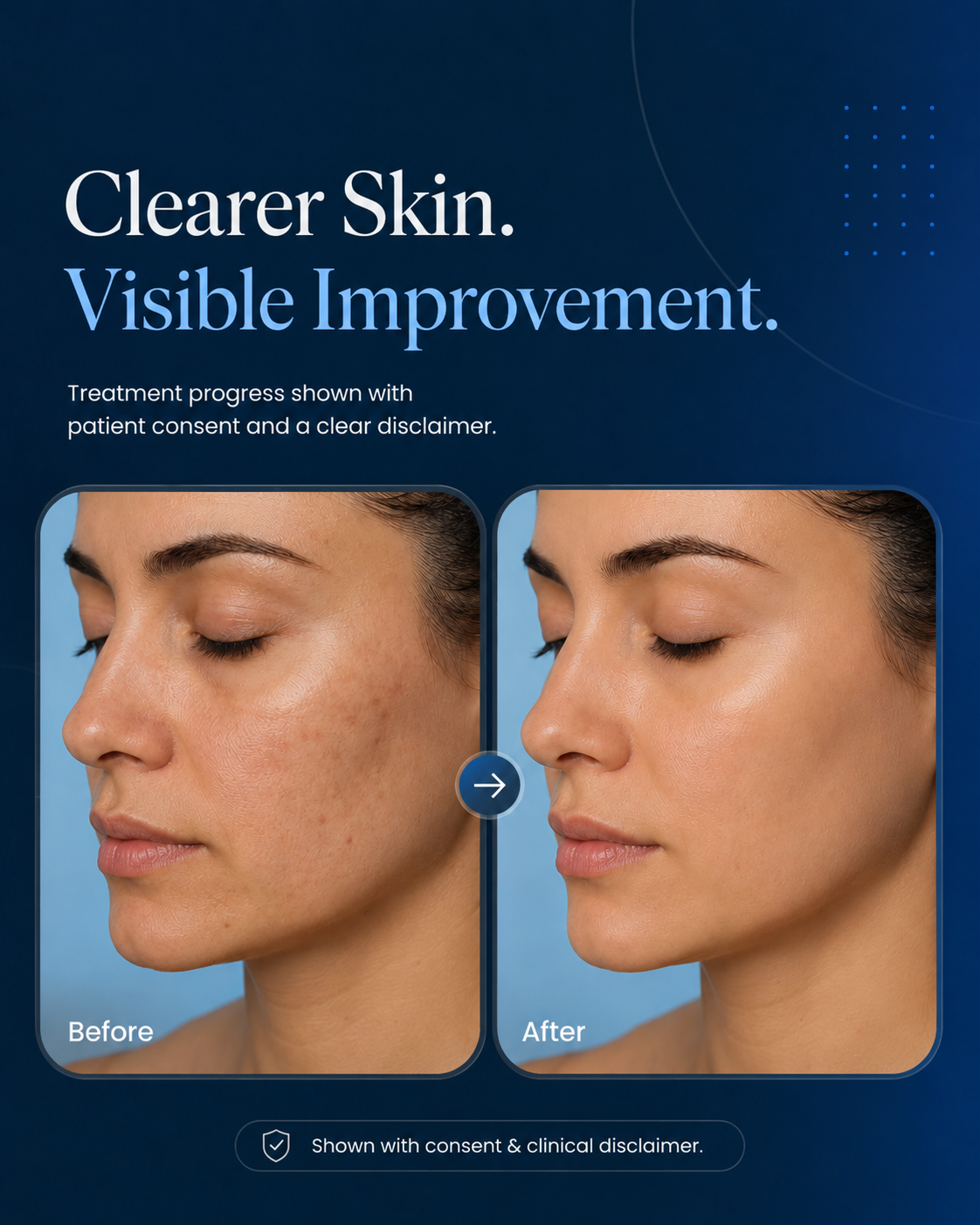 Clearer skin visible improvement